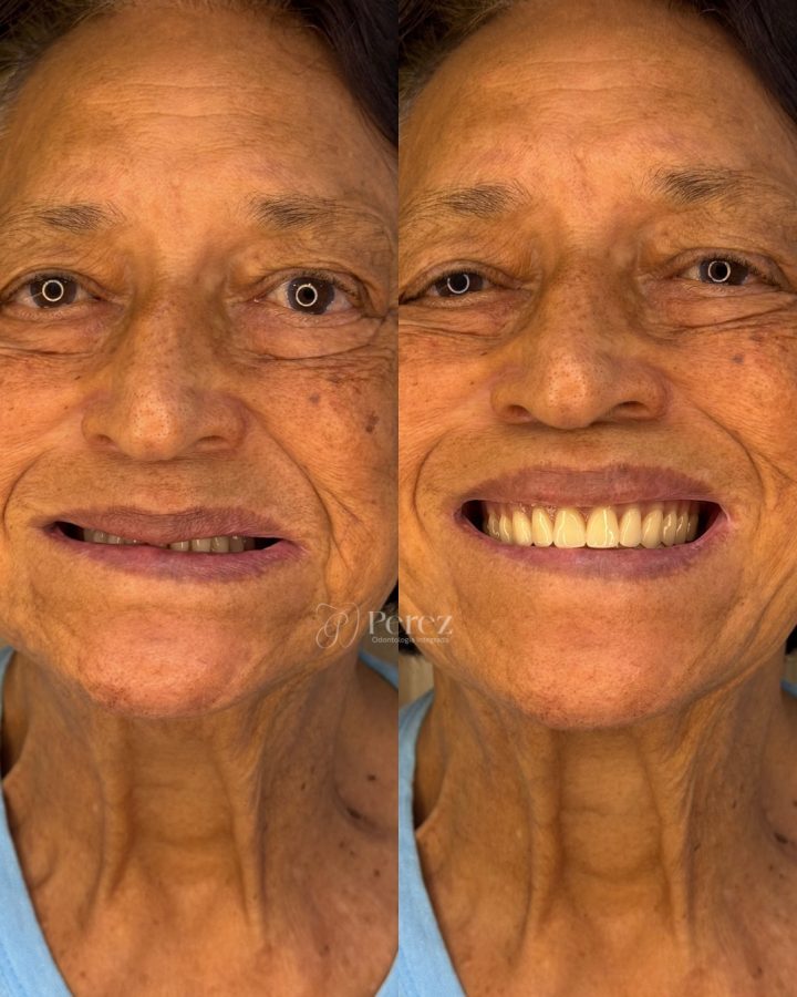 antes e depois novo 1 (ja tem)