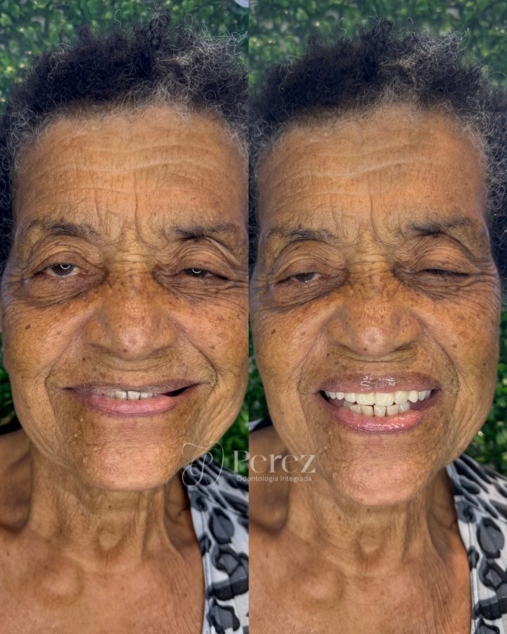 antes e depois novo 2