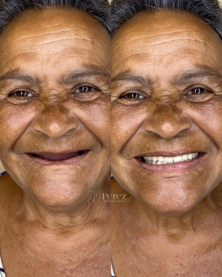 antes e depois novo 4
