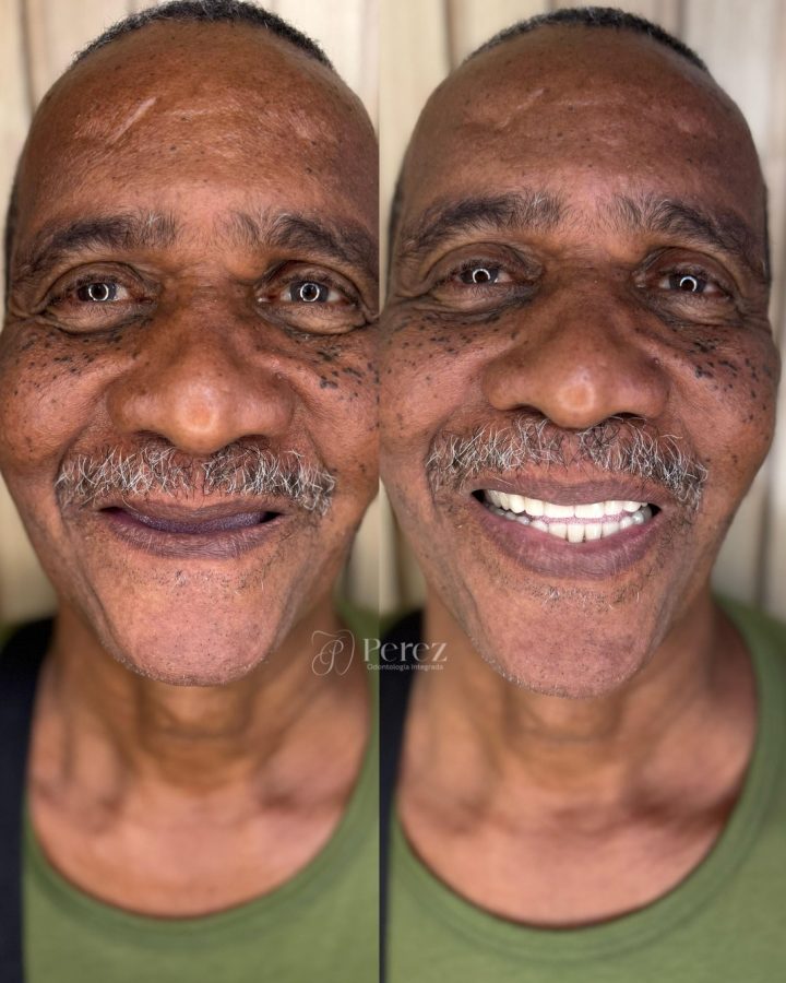 antes e depois novo 7